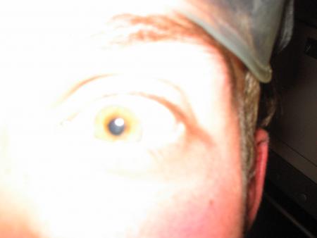 Oeil Rom